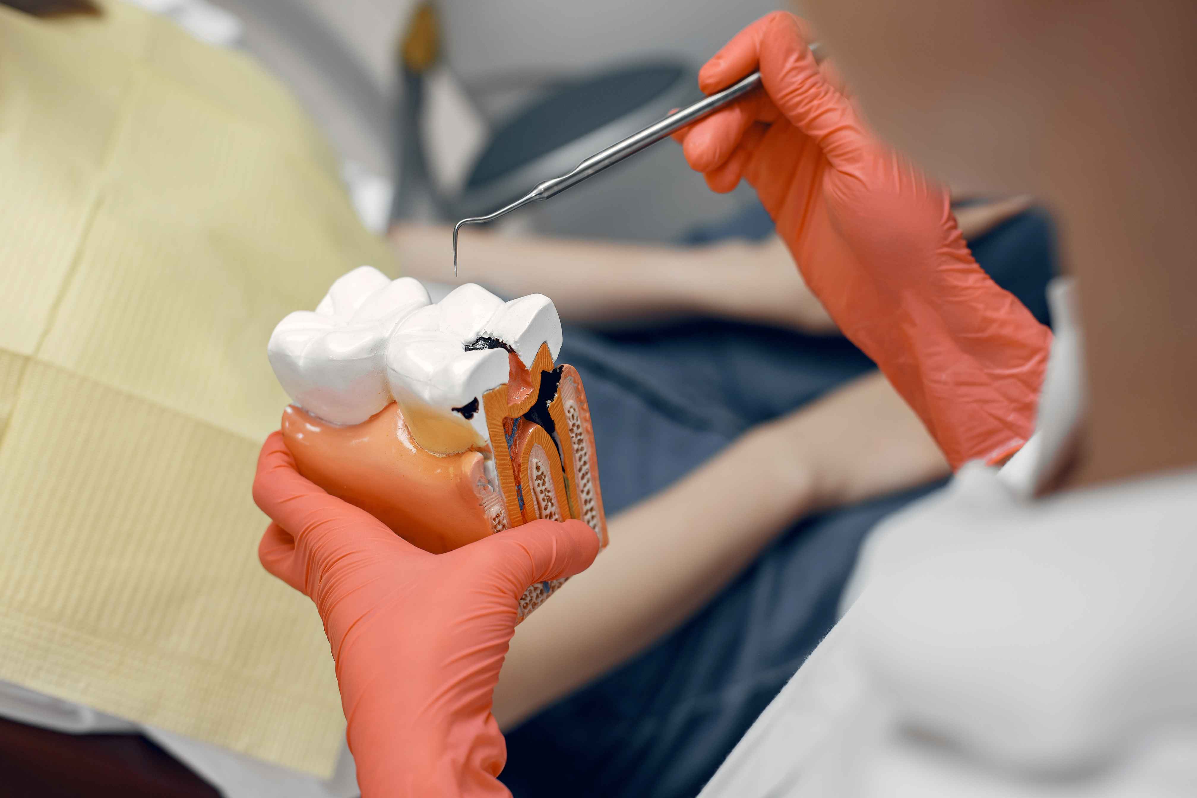 Tooth Root Injection Bombay Dental Company Worli | Best Dentist in Worli | Dr. Tushita Singh